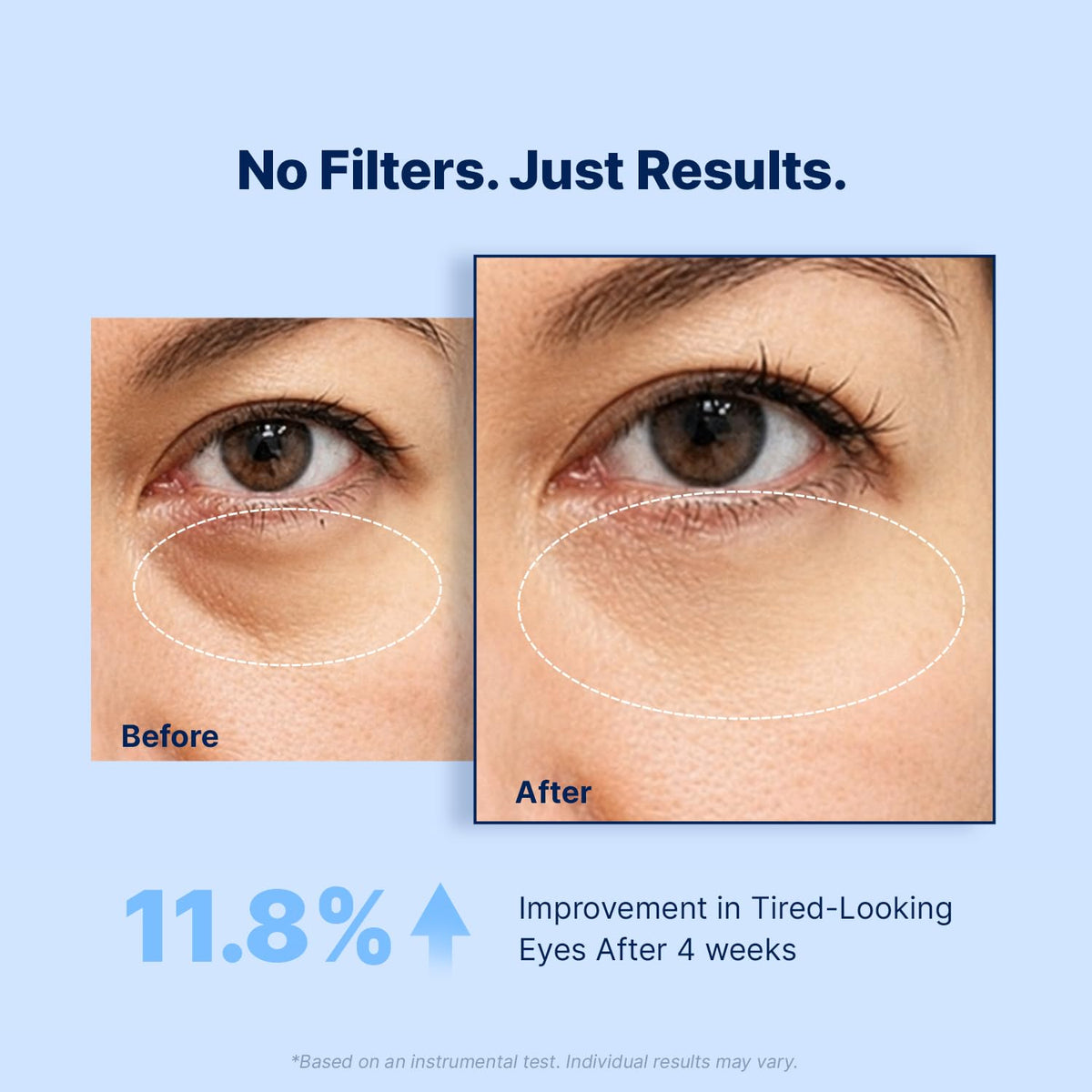 Enaskin Naturals Under Eye Patches for Puffy Eyes & Dark Circles 60 Patches