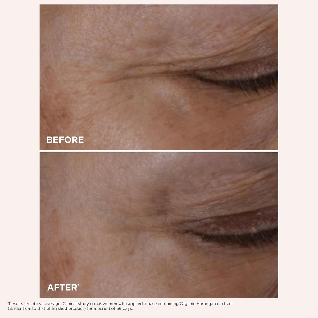CLARINS Total Eye Lift All-in-One Anti-Aging Eye Cream