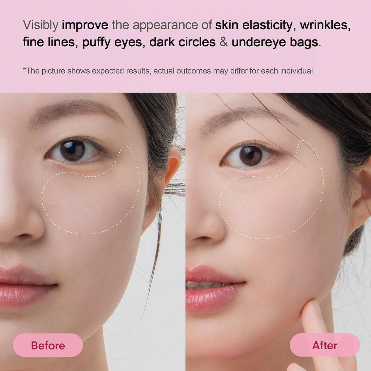 TEREZ & HONOR Peptide Collagen Under Eye Patches - 60 Korean Firming, Glowing & Hydrating Hydrogel Mask for Puffy Eyes, Dark Circles, Wrinkles, Fine Lines, Undereye Bags - Anti-Aging Eye Gel Pads