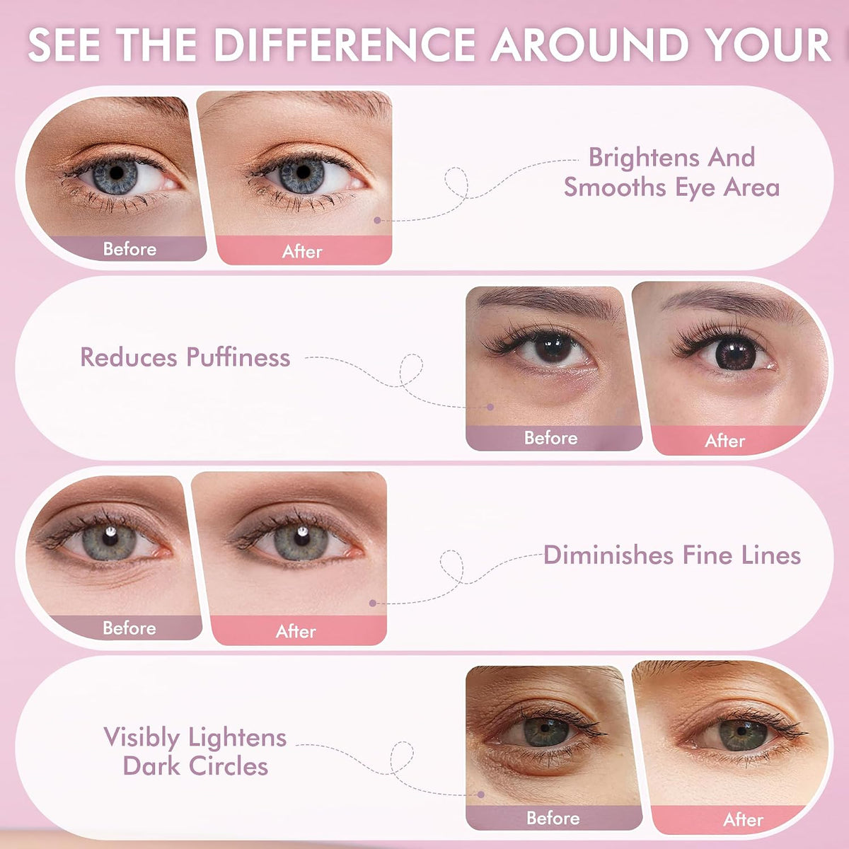 Under Eyes Patches, 40 Pairs Rose Hydrogel Eye Mask for Puffy Eyes and Dark Circles with Rose Essence, Hyaluronic Acid & Niacinamide, Deep Hydrating Eye Treatment for Men & Women