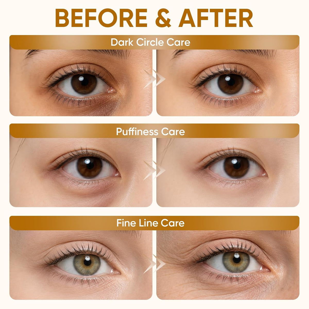100 Pairs Eye Masks for Dark Circles, Puffy Eyes, Undereye Bags, Wrinkles