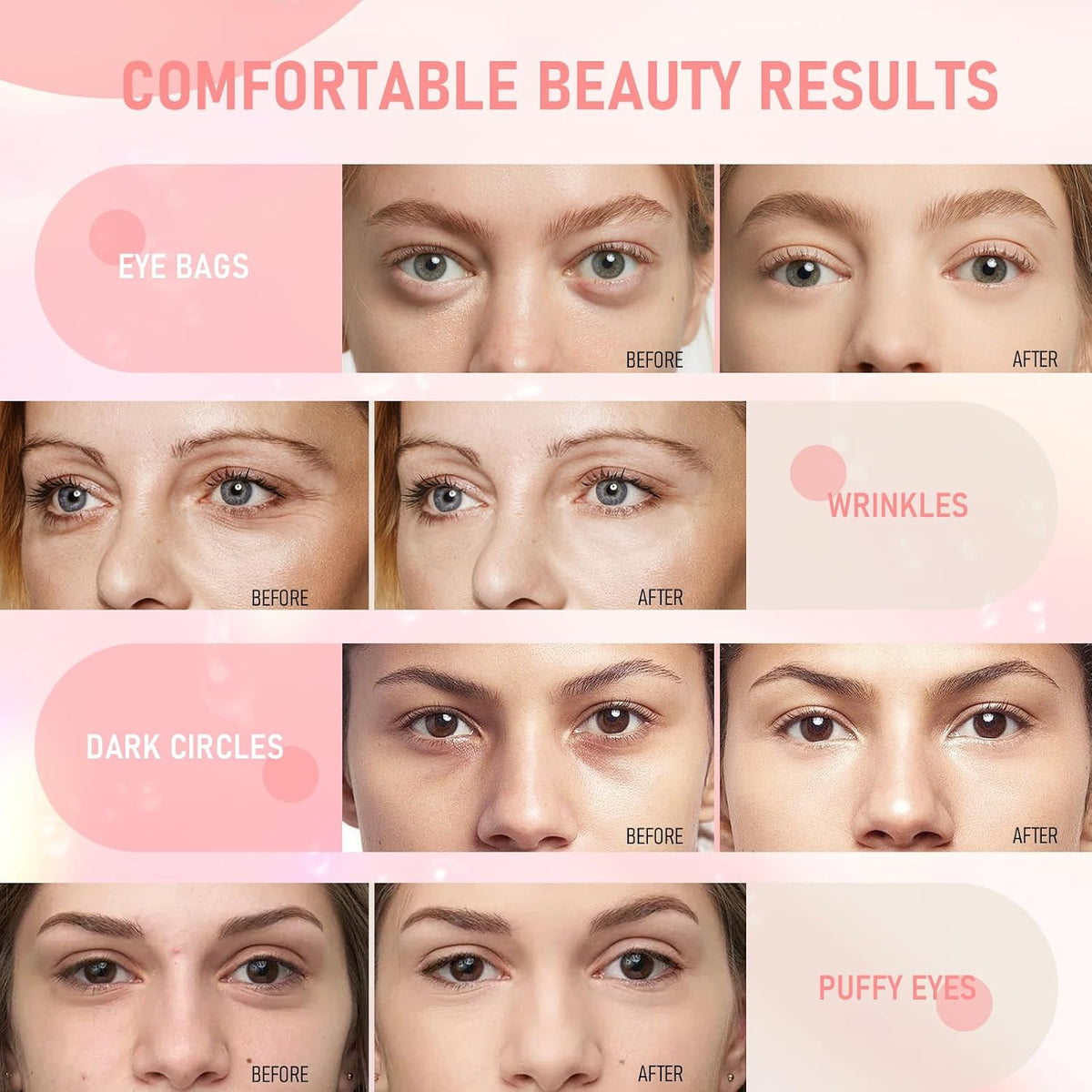 Eye Mask, 30-Pair Collagen Rose Eye Patches for Puffy Eyes and Dark Circles