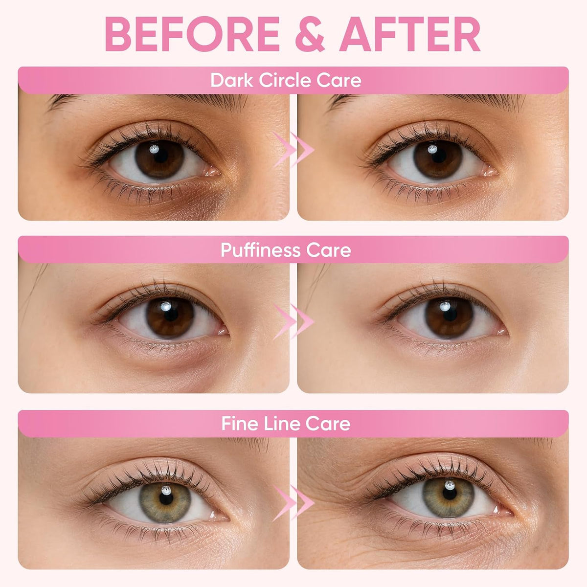 Under Eye Patches 48Pairs for Dark Circles, Puffy Eyes, Skincare Spa Gifts