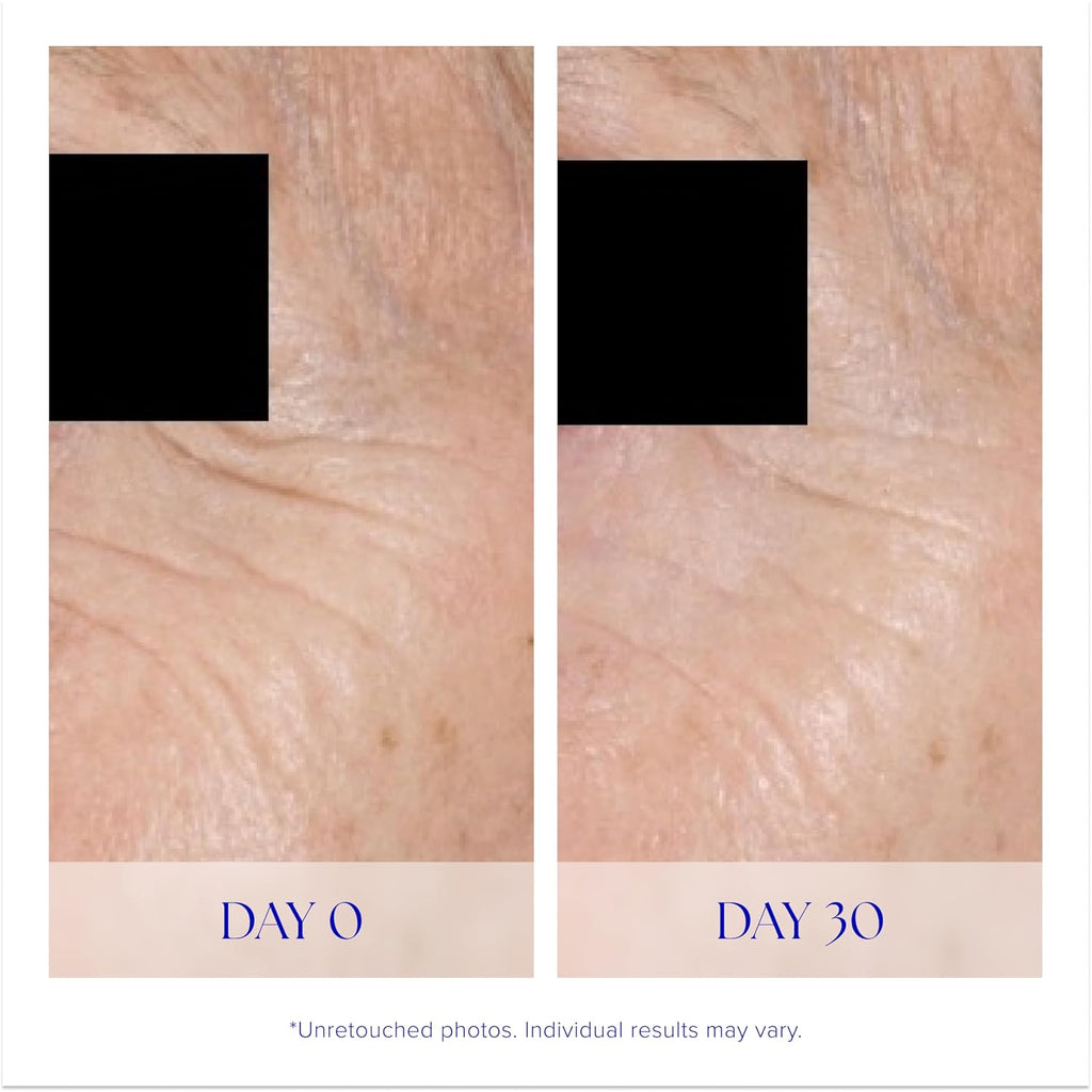iS CLINICAL Youth Eye Complex, Anti-Aging Brightening Under Eye Cream, Reduces Puffiness, Hydrating and Firming Eye Cream