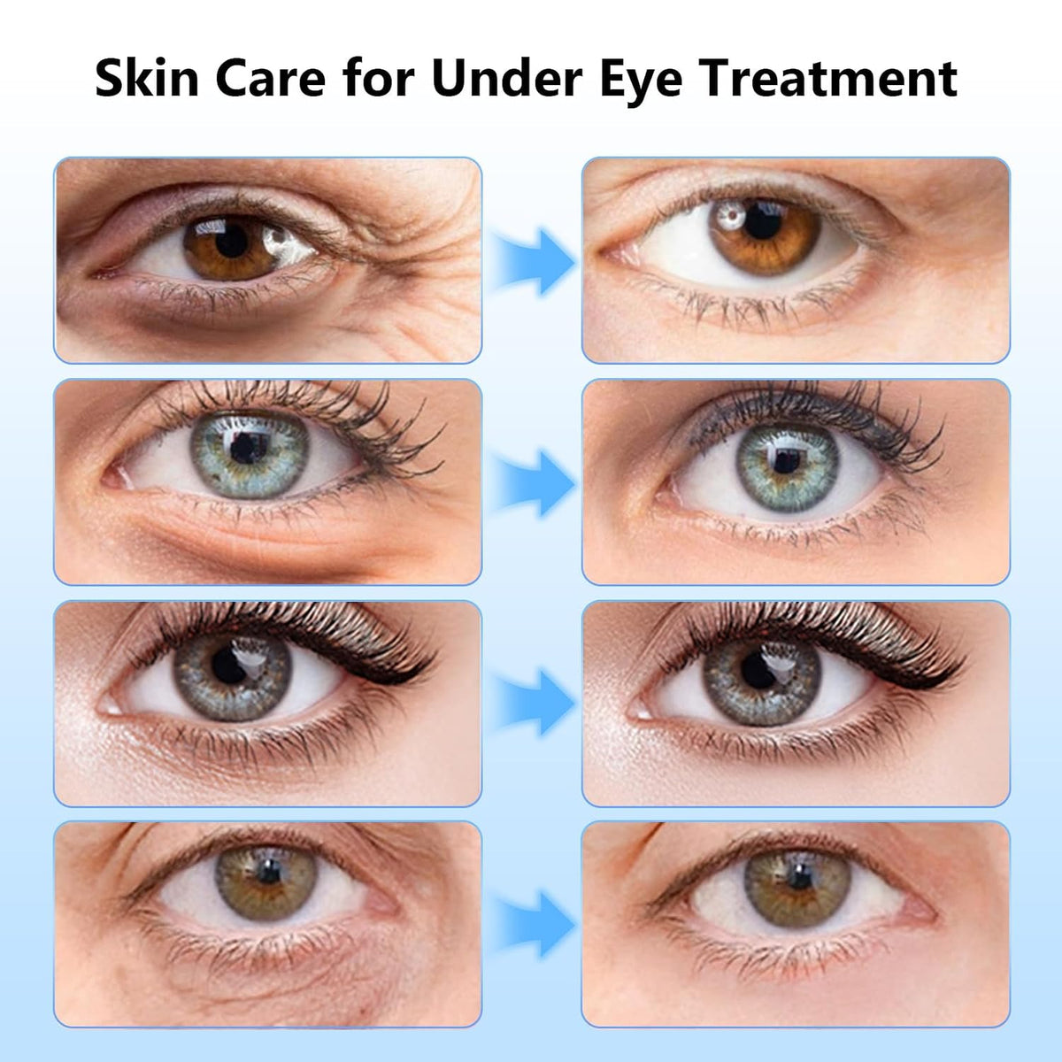 Adofect Under Eye Patches 40 Pairs, Eye Masks with 24K Gold, Hyaluronic Acid, Caffeine & Retinol for Dark Circles, Puffy Eyes, Under Eye Bags, Skincare Gifts for Bachelorette Party Accessories