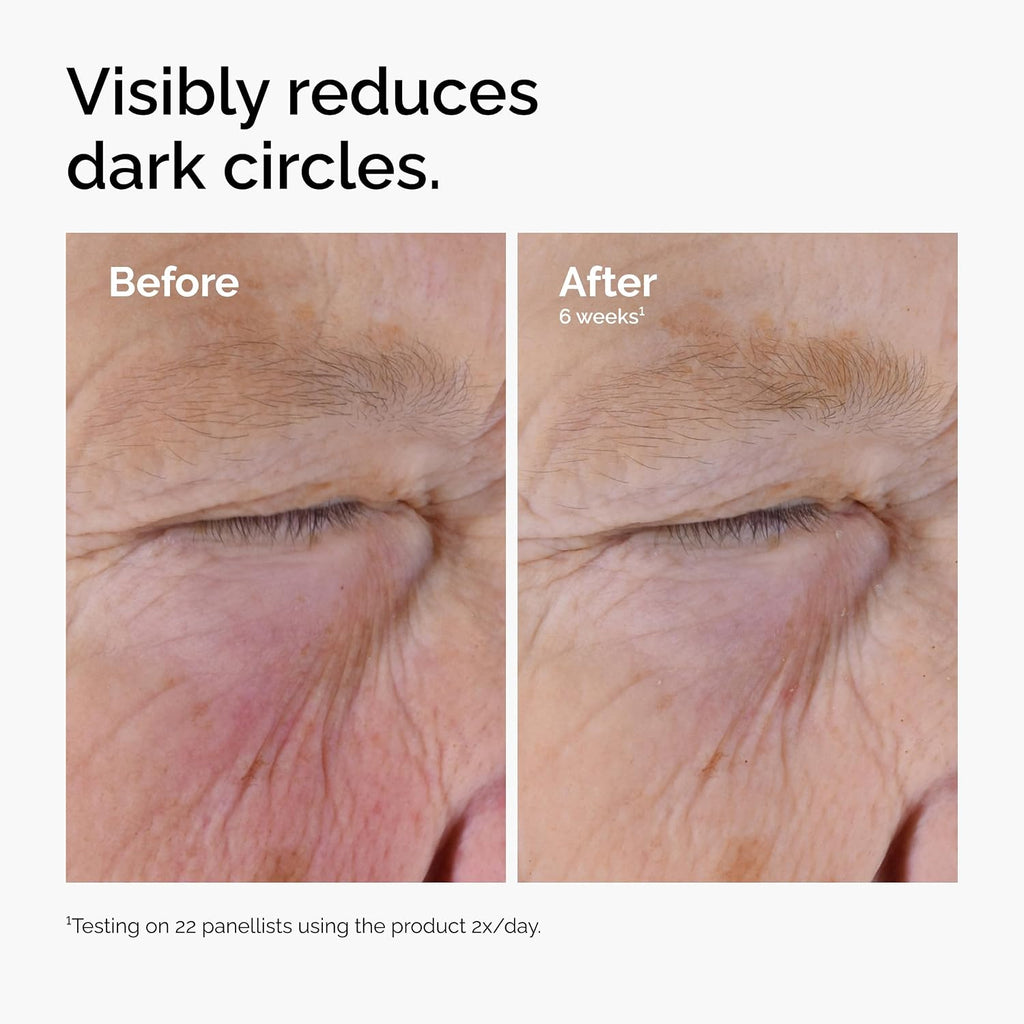 The Ordinary Caffeine Solution 5% + EGCG Eye Serum, Depuffing Eye Serum for Dark Circles and Tired Eyes