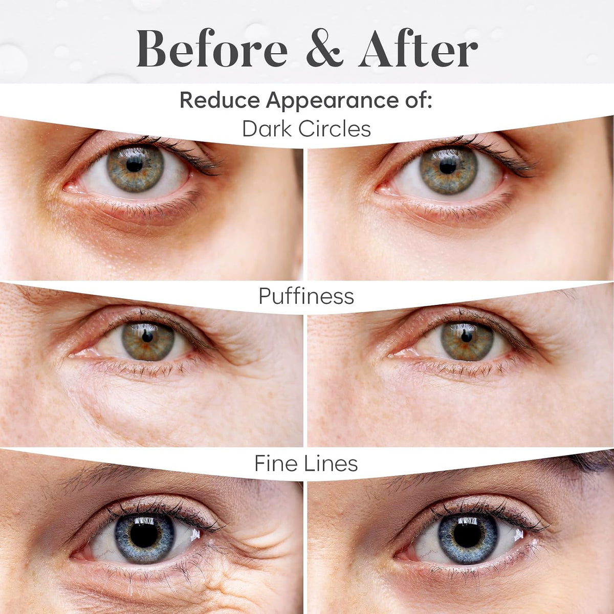 BLOOMORA Variety Under Eye Patches (30 Pairs) - For Dark Circles & Puffiness - Eye Mask for Care