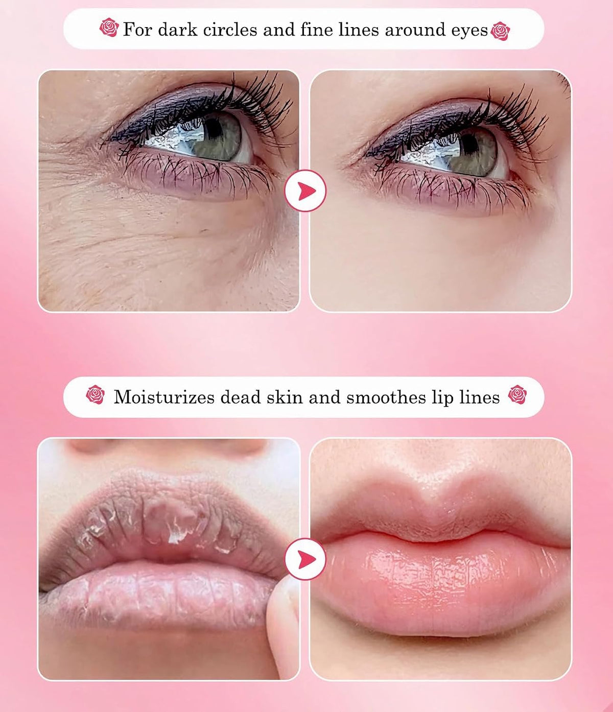 YMEYFAN 20 Pair Under Eye Mask & Lip Mask Skincare Set, Rose Pink Lip Patches & Under Eye Patches for Puffy Eyes, Dark Circles, Dry Lips Lines, Deep Hydrating Moisturizing, Gifts for Mom Women