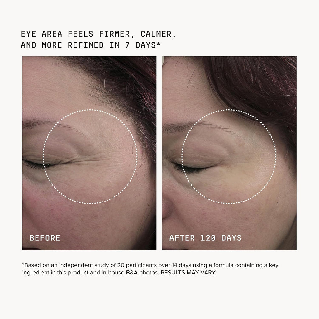 DRMTLGY HPR Eye Cream | Anti-Aging Undereye Cream