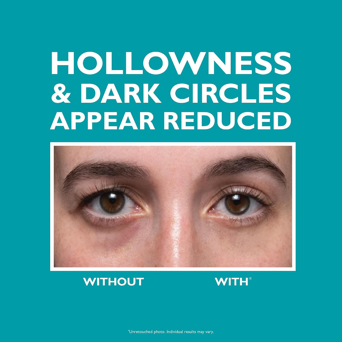 Peter Thomas Roth | Peptide Skinjection Fill + Fix Under-Eye Cream