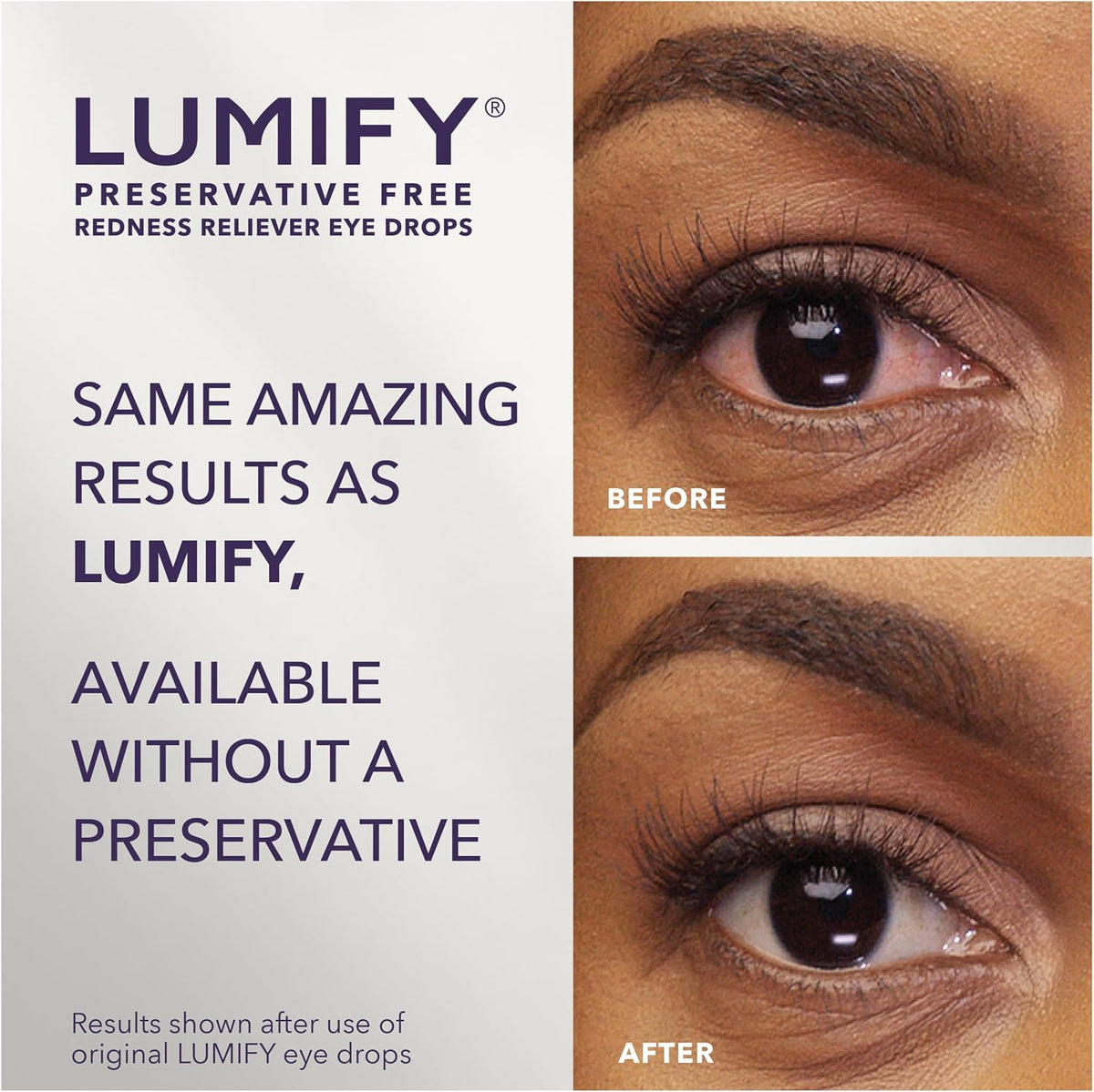 Lumify Preservative Free Eye Drops Redness Relief, Sensitive Eyes, 20 Vials