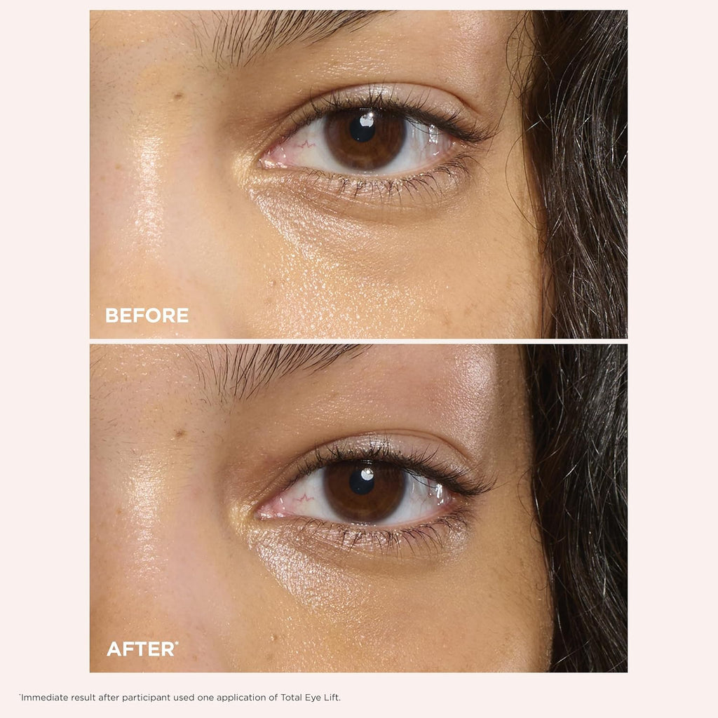 CLARINS Total Eye Lift All-in-One Anti-Aging Eye Cream