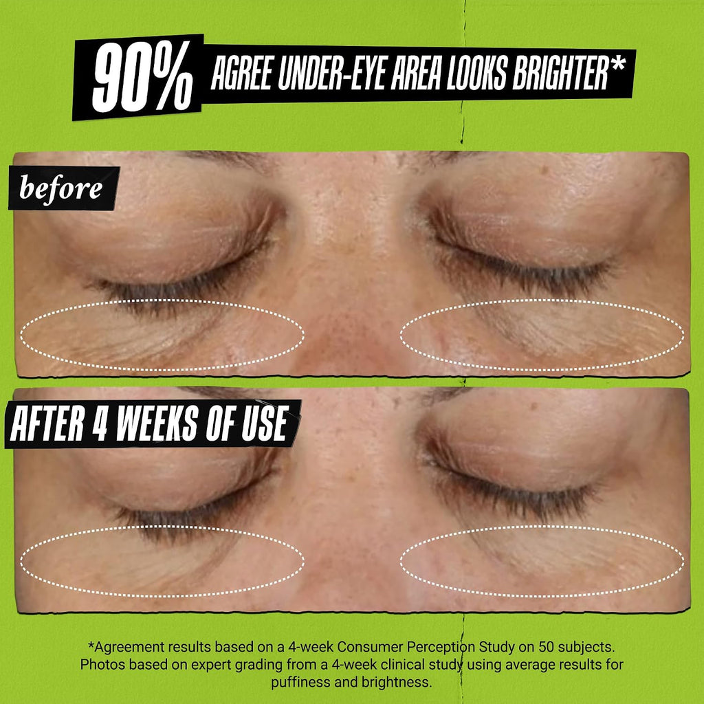 Kiehl's - Avocado Eye Treatment, for Dry Lines & Puffiness