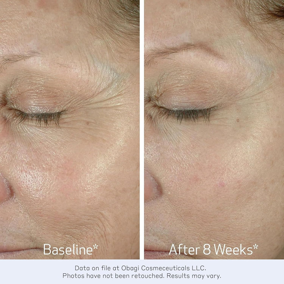Obagi ELASTIDERM Eye Cream