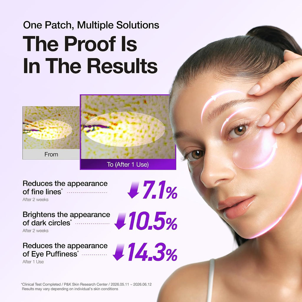 ANUA Retinol Berry Eye Patches, 60 Count