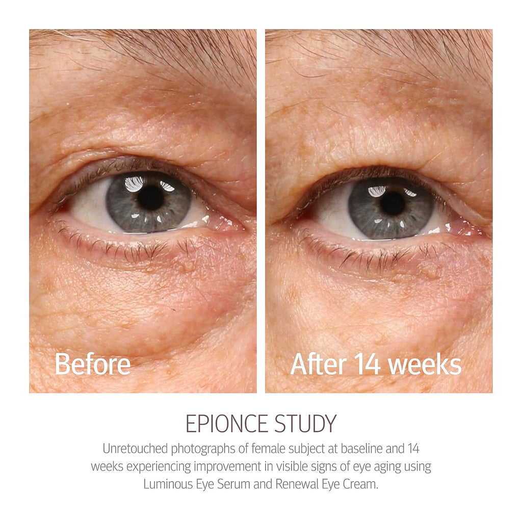 Epionce Renewal Eye Cream Anti-Aging Under Eye Cream Dark Circles Puffiness