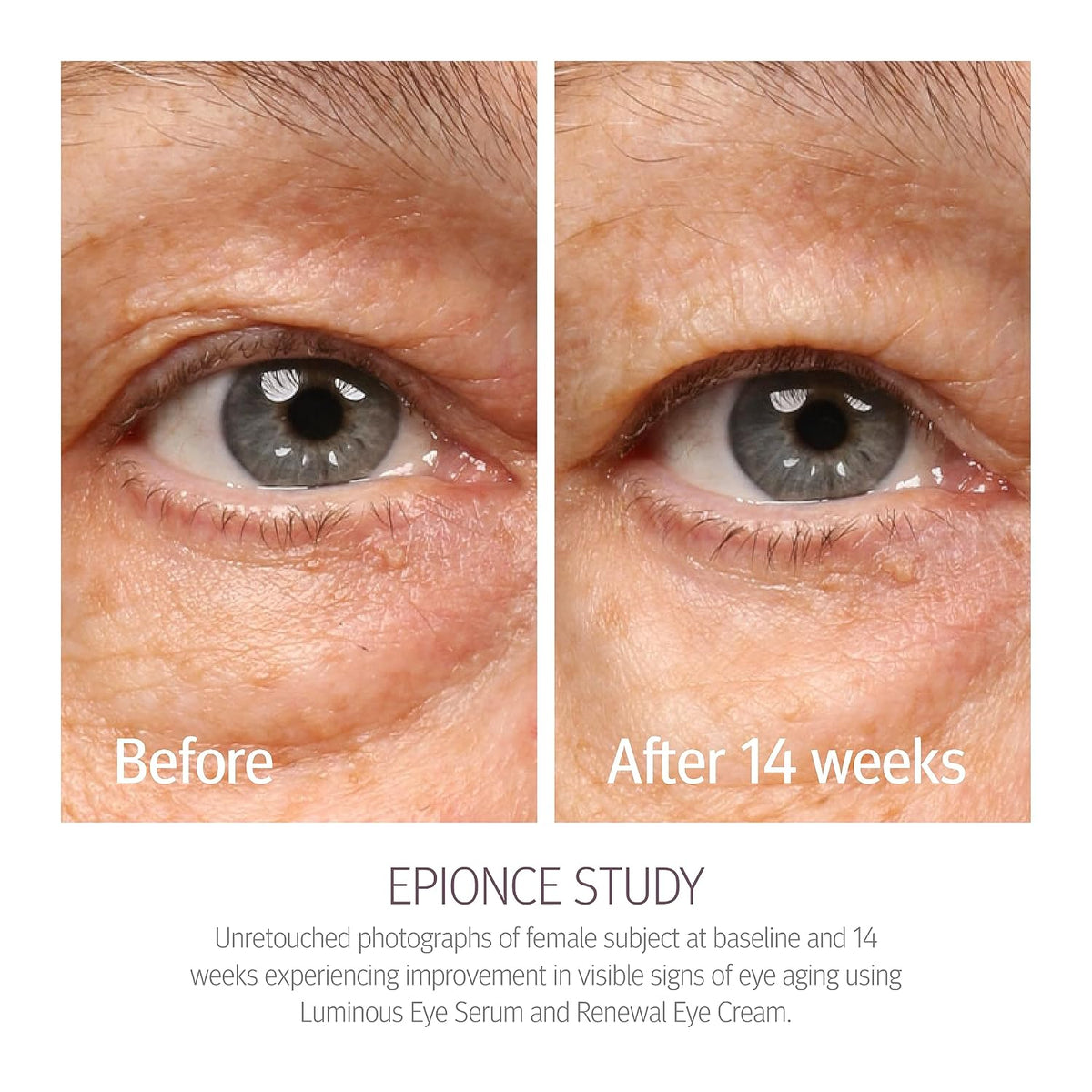 Epionce Renewal Eye Cream Anti-Aging Under Eye Cream Dark Circles Puffiness