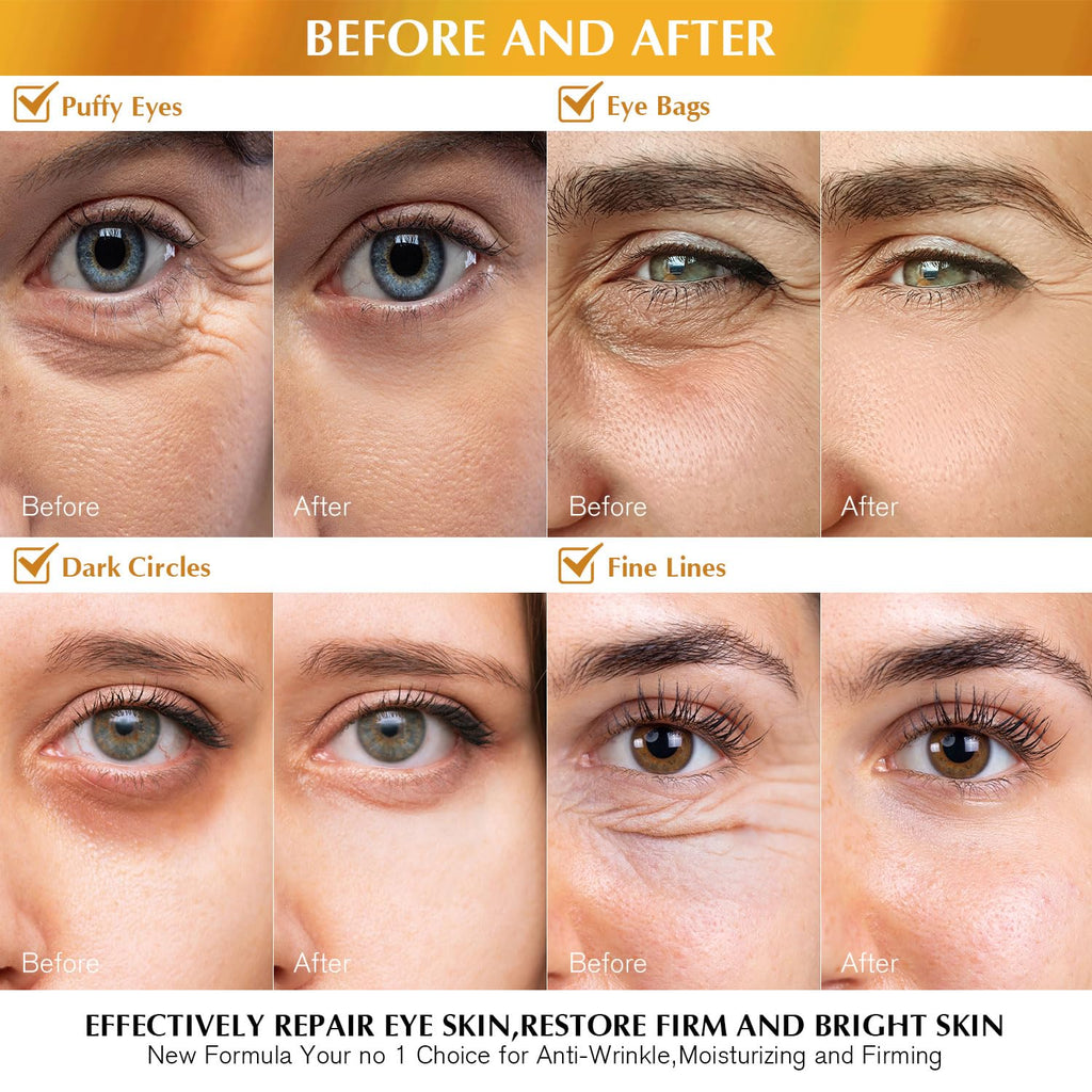 Enaskin Naturals 24K Gold Under Eye Patches for Dark Circles & Puffiness